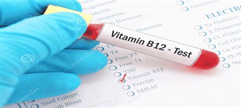 vitamin d and b12 test package|vitamin b12 blood test cost.